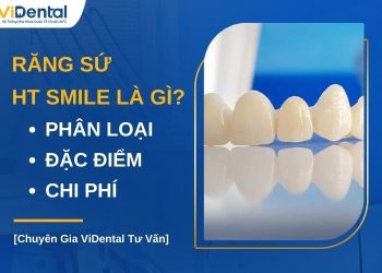 Răng sứ HT Smile có tốt không