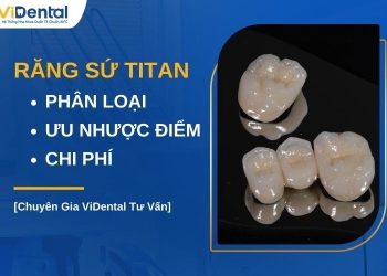 Răng sứ Titan có tốt không