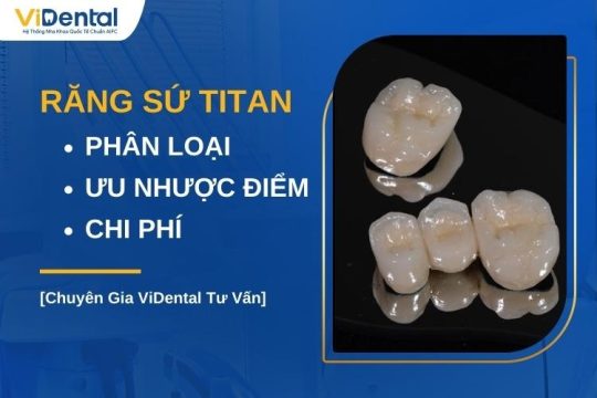 Răng sứ Titan có tốt không