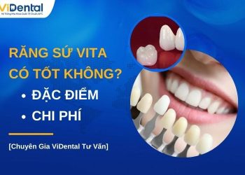 Răng sứ Vita có tốt không