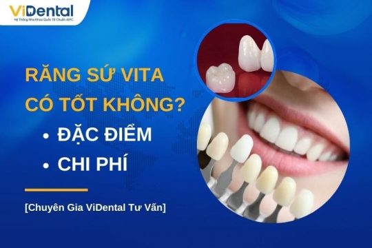 Răng sứ Vita có tốt không
