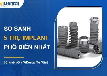 So sánh các loại trụ Implant