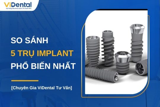 So sánh các loại trụ Implant