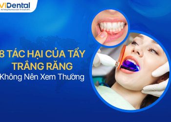 8 Tác Hại Của Tẩy Trắng Răng Bạn Không Nên Xem Thường