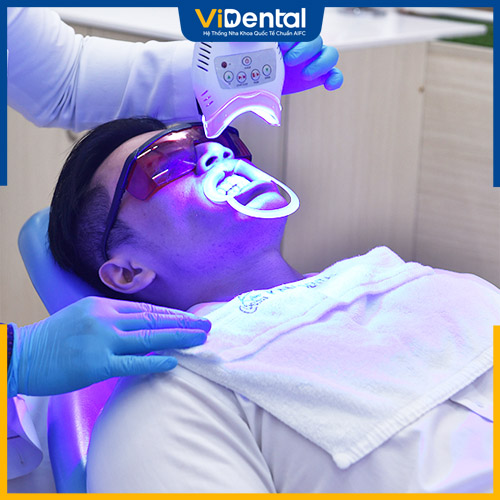 Tẩy trắng răng tại nha khoa cho hiệu quả cao