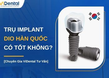 Trụ Implant DIO Hàn Quốc có tốt không