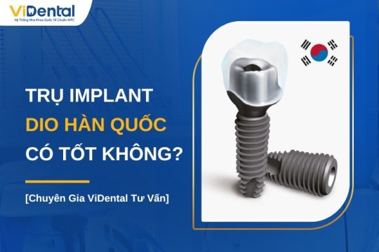 Trụ Implant DIO Hàn Quốc có tốt không