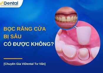 Bọc răng cửa bị sâu có được không