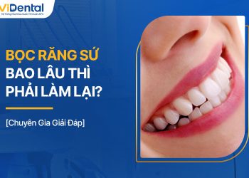 Bọc Răng Sứ Bao Lâu Thì Phải Làm Lại?