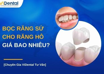 Bọc răng sứ cho răng hô giá bao nhiêu