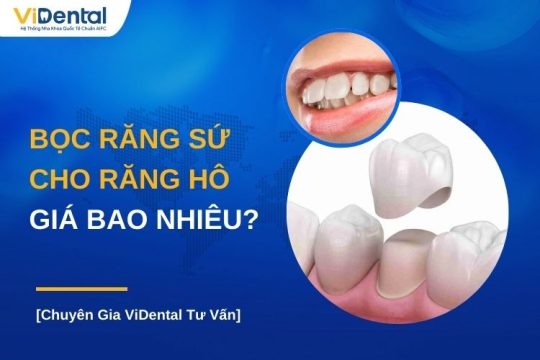 Bọc răng sứ cho răng hô giá bao nhiêu