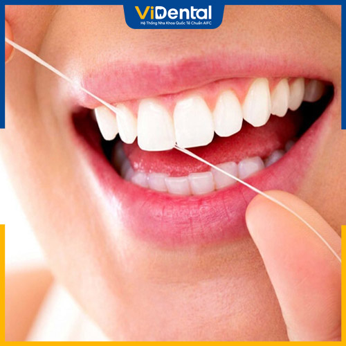 Độ bền răng sứ phụ thuộc vào cách chăm sóc tại nhà