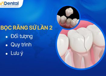 Bọc Răng Sứ Lần 2 Khi Nào? Quy Trình Và Lưu Ý Thực Hiện