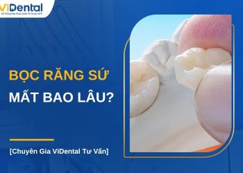 Bọc răng sứ mất bao lâu