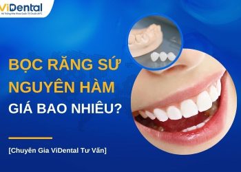 Bọc răng sứ nguyên hàm giá bao nhiêu