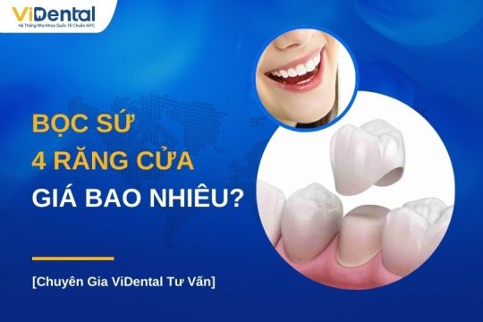 Bọc sứ 4 răng cửa giá bao nhiêu