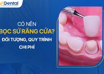 Có Nên Bọc Sứ Răng Cửa? Đối Tượng, Quy Trình, Chi Phí Thực Hiện