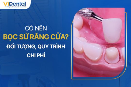 Có Nên Bọc Sứ Răng Cửa? Đối Tượng, Quy Trình, Chi Phí Thực Hiện