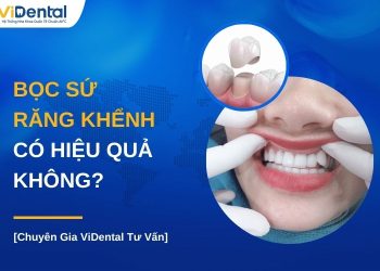 Bọc sứ răng khểnh có hiệu quả không