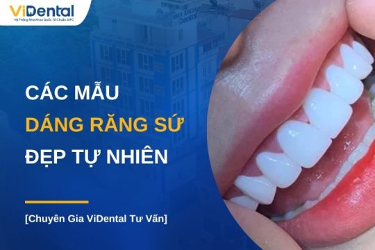 Các mẫu dáng răng sứ đẹp tự nhiên