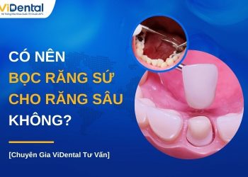 Có nên bọc răng sứ cho răng sâu không