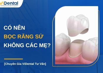 Có nên bọc răng sứ không các mẹ