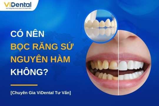 Có nên bọc răng sứ nguyên hàm không