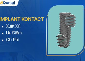 Implant Kontact: Xuất Xứ, Ưu Điểm, Chi Phí Cập Nhật Mới Nhất