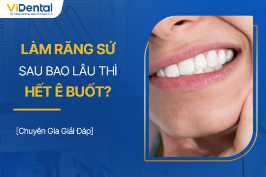 Làm Răng Sứ Sau Bao Lâu Thì Hết Ê Buốt? Chuyên Gia Giải Đáp