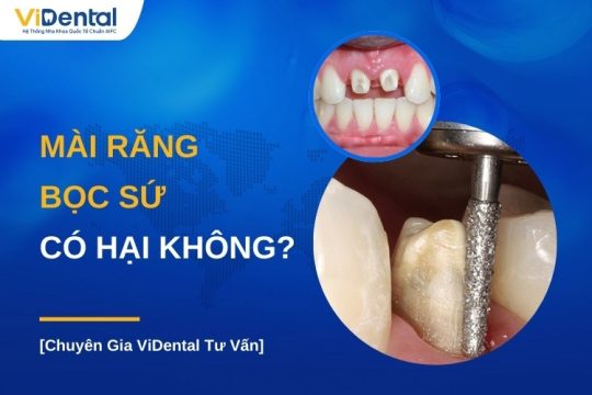 Mài răng bọc sứ có ảnh hưởng sức khỏe không
