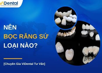 Nên bọc răng sứ loại nào