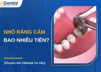 Nhổ răng cấm bao nhiêu tiền