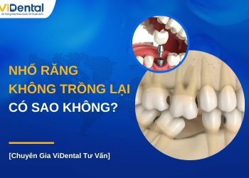 Nhổ răng không trồng lại có sao không