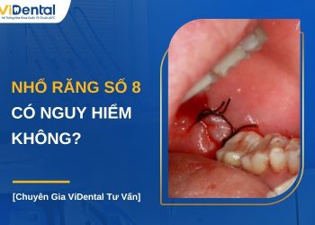 Nhổ răng số 8 có nguy hiểm không