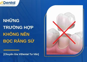 Những trường hợp không nên bọc răng sứ