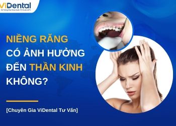 Niềng răng có ảnh hưởng đến thần kinh không