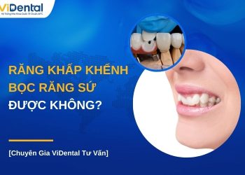 Răng khấp khểnh có bọc răng sứ được không