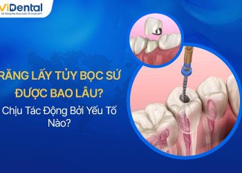 Răng Lấy Tủy Bọc Sứ Được Bao Lâu, Chịu Tác Động Bởi Yếu Tố Nào?