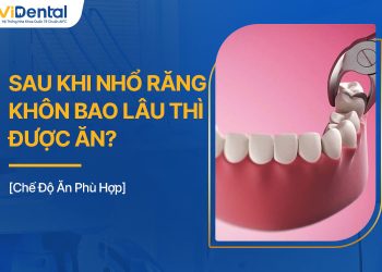 Sau Khi Nhổ Răng Khôn Bao Lâu Thì Được Ăn?