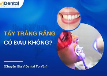 Tẩy trắng răng có đau không