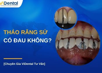 Tháo răng sứ có đau không