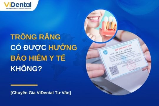 Trồng răng có được hưởng bảo hiểm y tế không