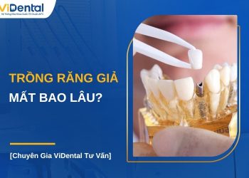 Trồng răng giả mất bao lâu