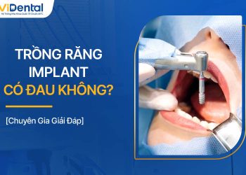 Trồng Răng Implant Có Đau Không? Chuyên Gia Tư Vấn