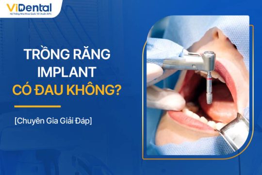 Trồng Răng Implant Có Đau Không? Chuyên Gia Tư Vấn