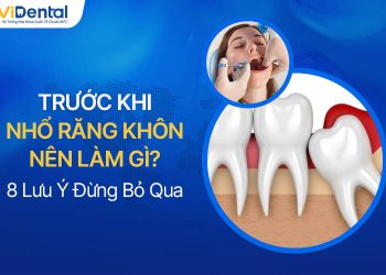 Trước Khi Nhổ Răng Khôn Nên Làm Gì? 8 Lưu Ý Đừng Bỏ Qua