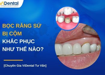 Bọc răng sứ bị cộm khắc phục thế nào