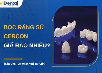 Bọc răng sứ Cercon giá bao nhiêu