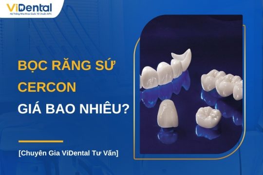 Bọc răng sứ Cercon giá bao nhiêu