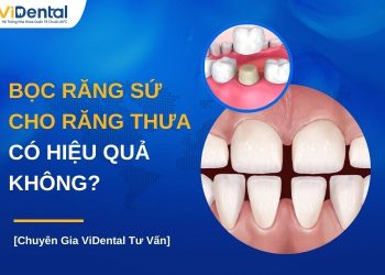 Bọc răng sứ cho răng thưa có hiệu quả không